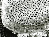 4 - Cellule epitalliche  disposte in cerchi concentrici